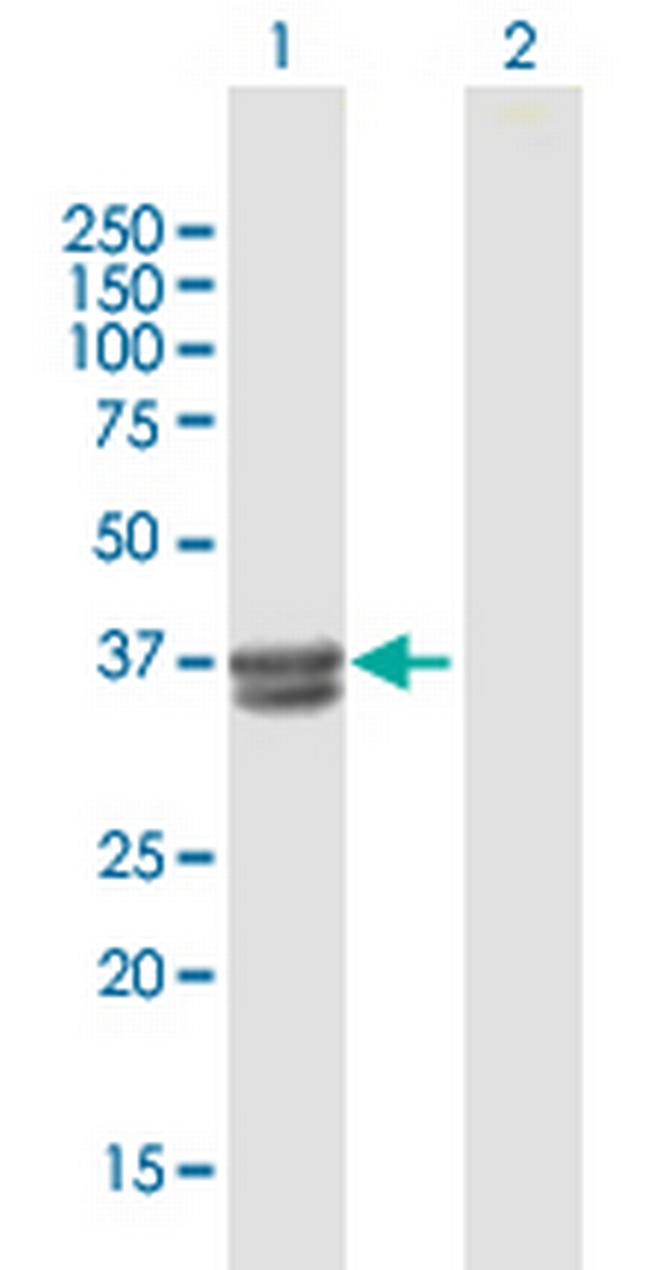 B3GALT6 Antibody in Western Blot (WB)