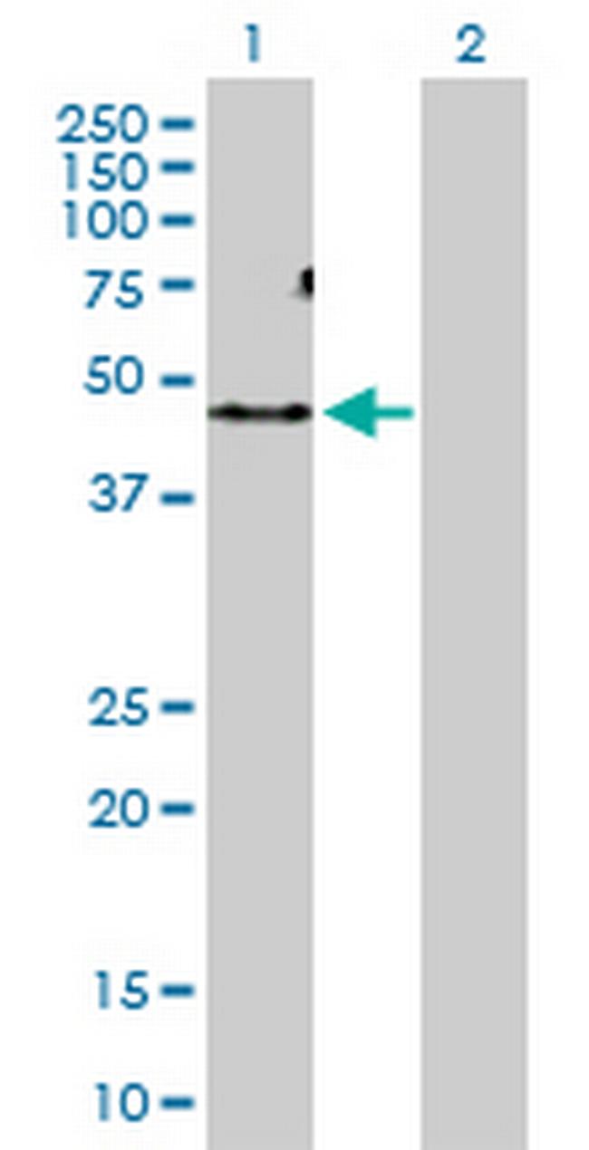 ACVR1C Antibody in Western Blot (WB)