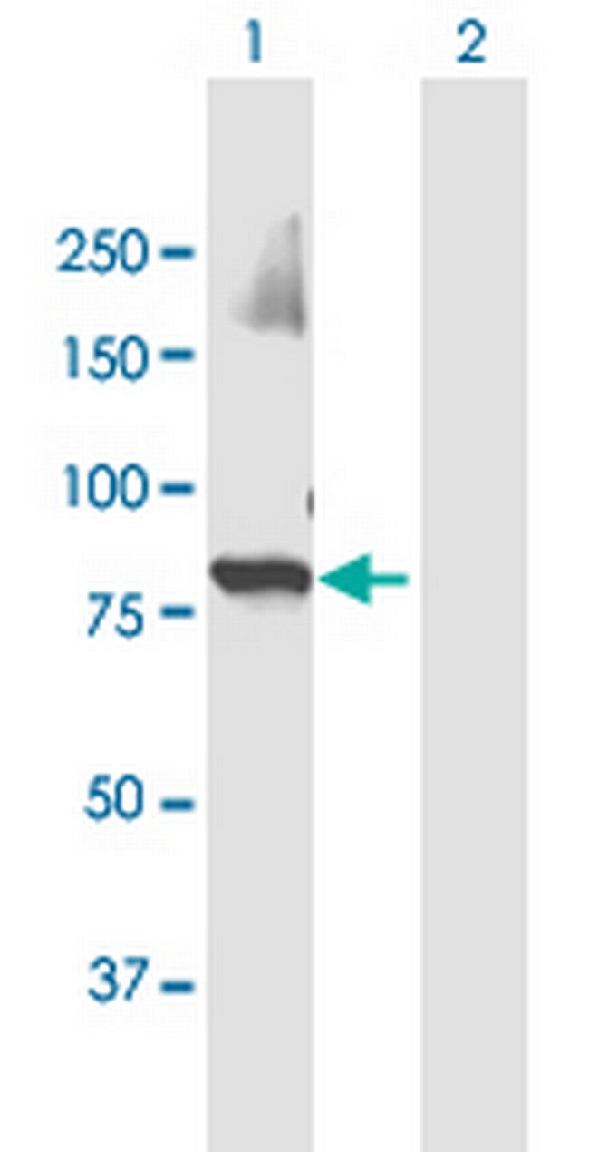 UBR3 Antibody in Western Blot (WB)