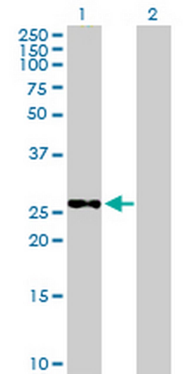 METTL6 Antibody in Western Blot (WB)