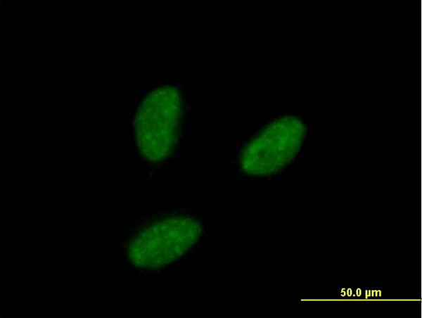 IRAK1BP1 Antibody in Immunocytochemistry (ICC/IF)