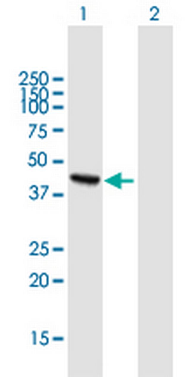 ADHFE1 Antibody in Western Blot (WB)