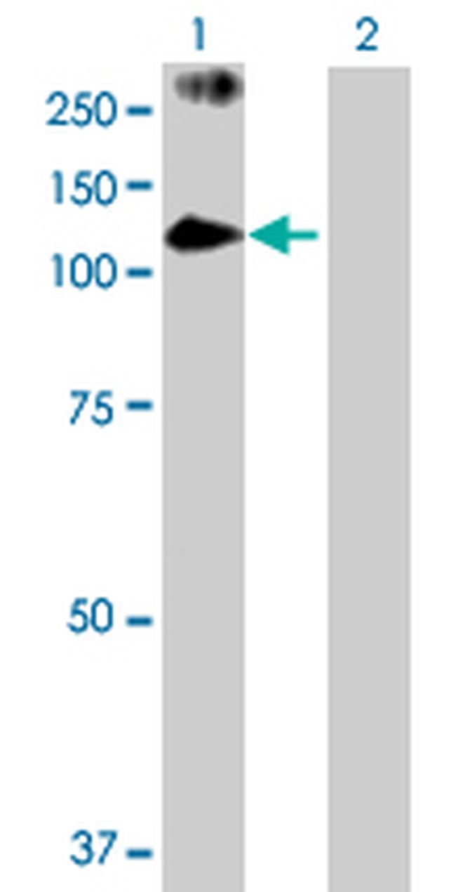 PASD1 Antibody in Western Blot (WB)