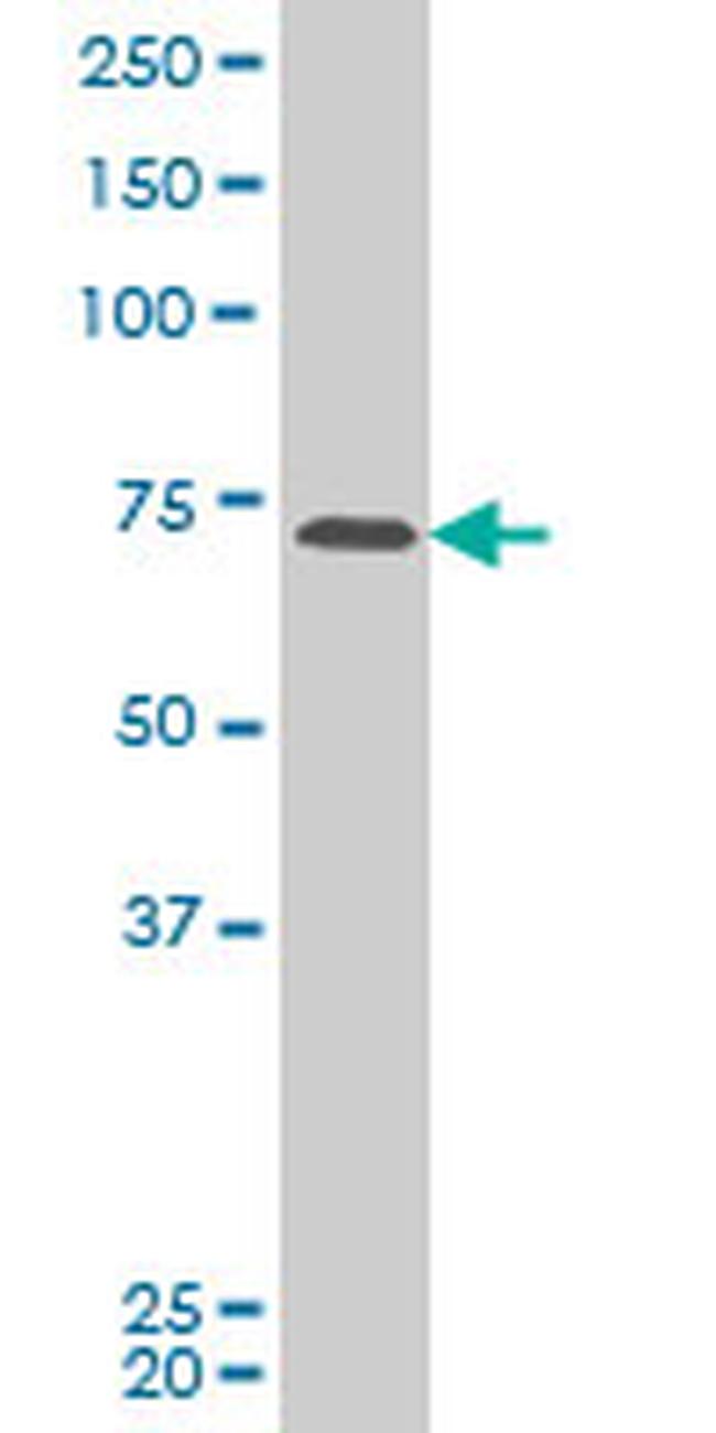 PASD1 Antibody in Western Blot (WB)