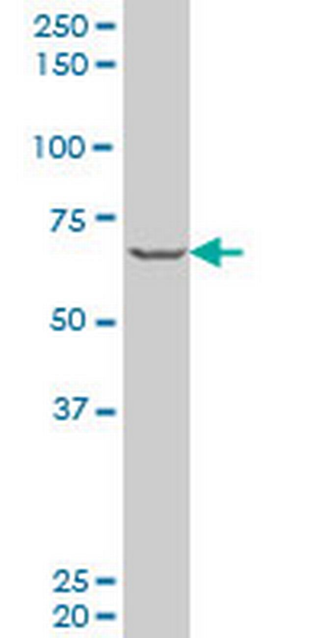 PASD1 Antibody in Western Blot (WB)