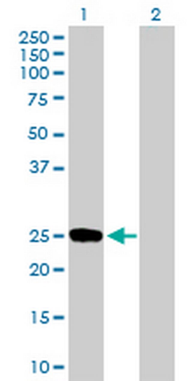 DUSP19 Antibody in Western Blot (WB)