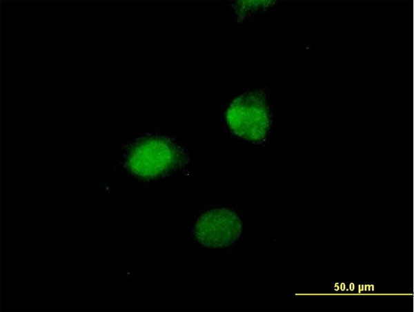 SESN3 Antibody in Immunocytochemistry (ICC/IF)