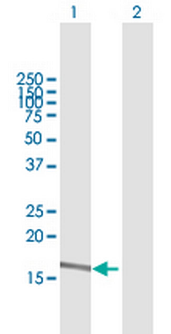 A2ML1 Antibody in Western Blot (WB)