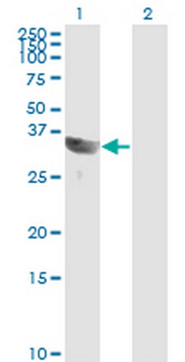 GSC Antibody in Western Blot (WB)