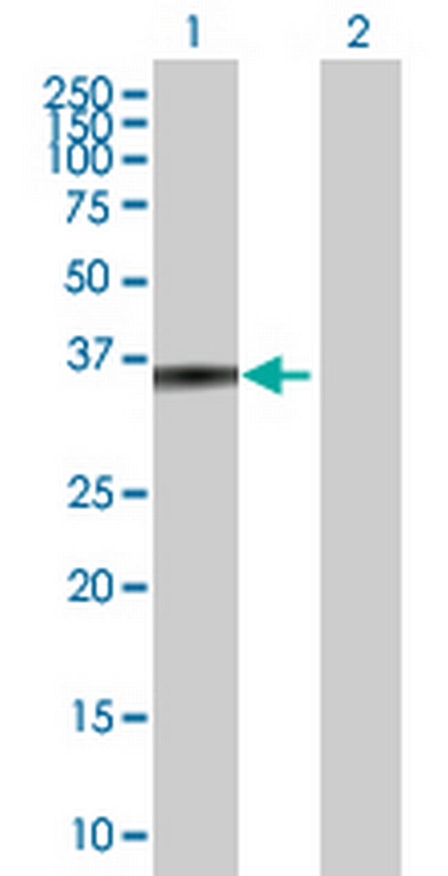 ZADH1 Antibody in Western Blot (WB)