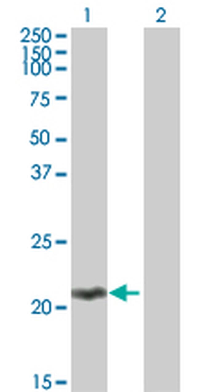 MOBKL2C Antibody in Western Blot (WB)