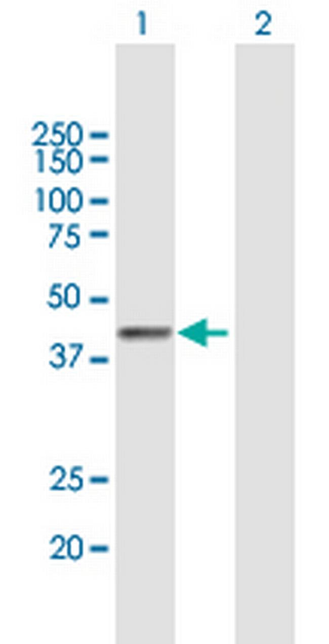 PLB1 Antibody in Western Blot (WB)