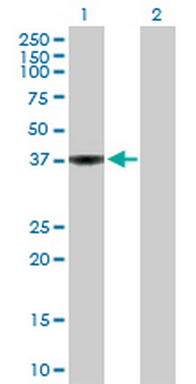 WDSUB1 Antibody in Western Blot (WB)