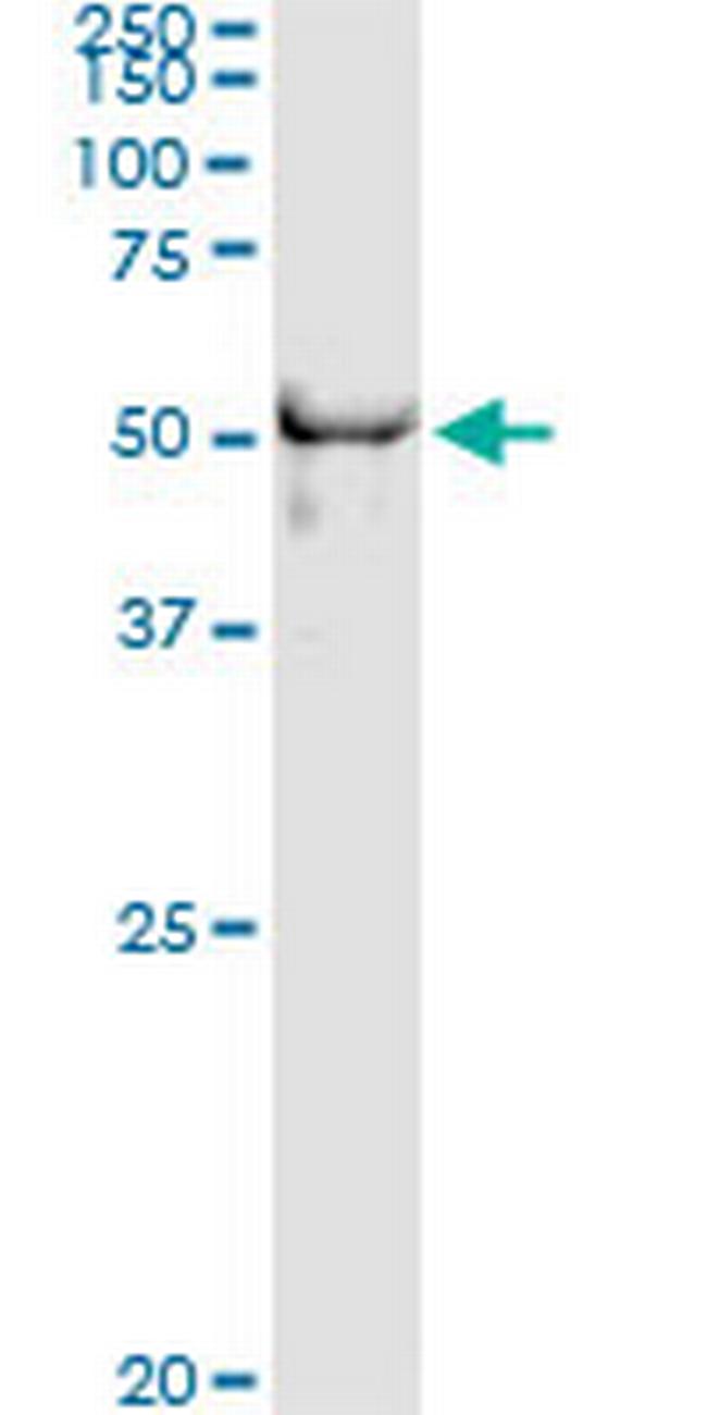 DYX1C1 Antibody in Immunoprecipitation (IP)
