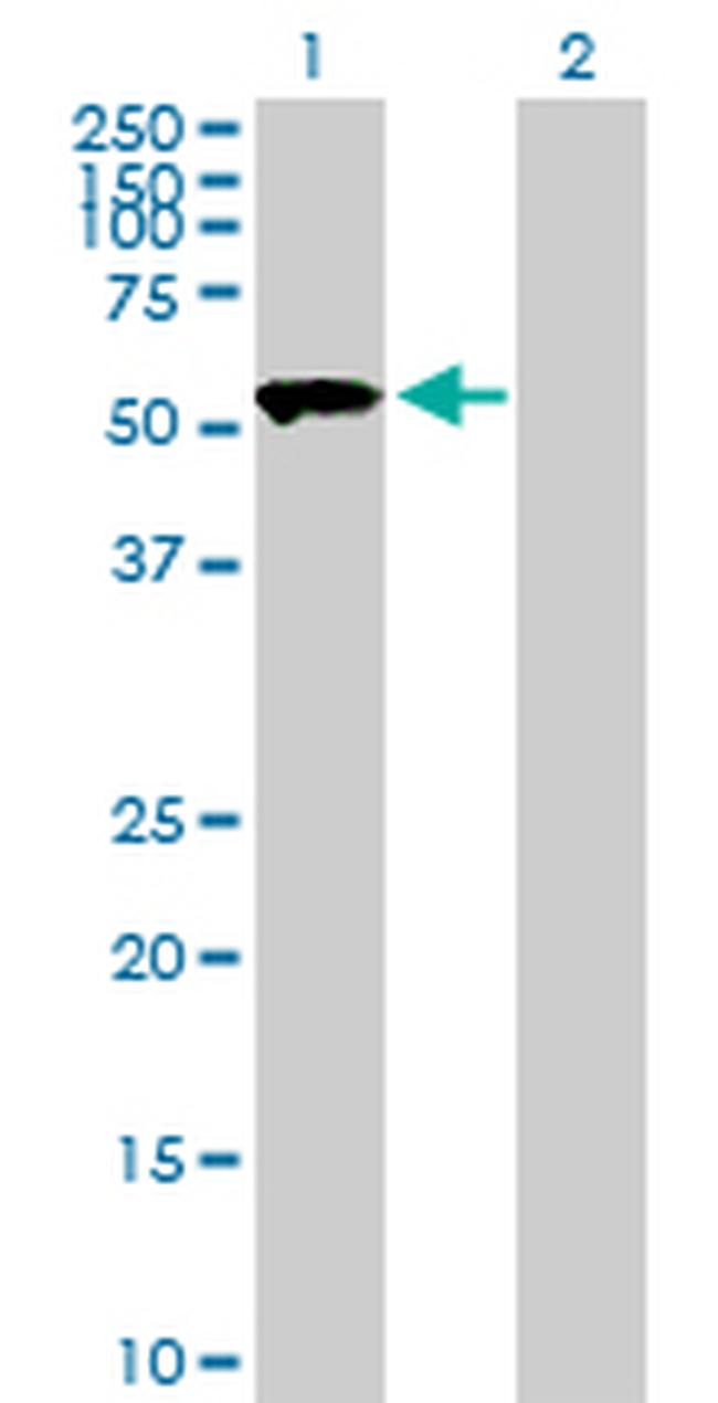 SASS6 Antibody in Western Blot (WB)