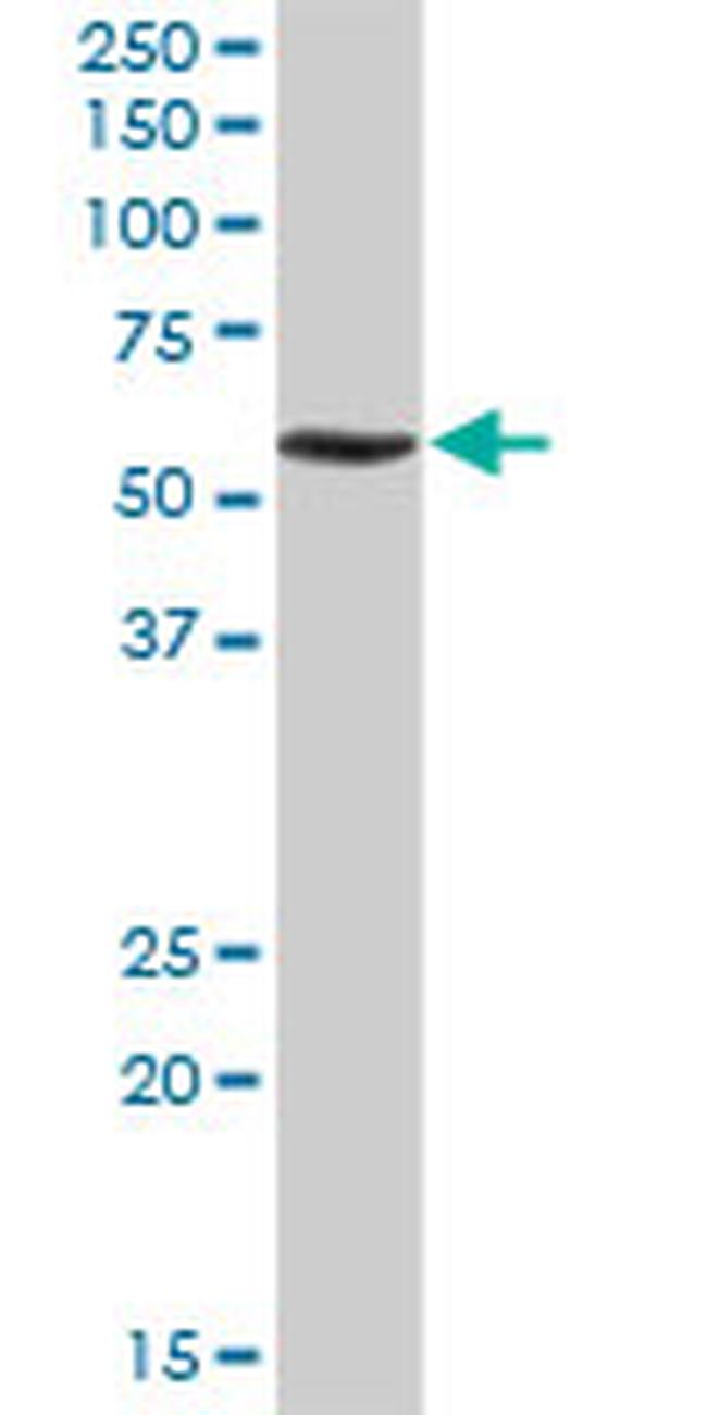 RNF168 Antibody in Western Blot (WB)