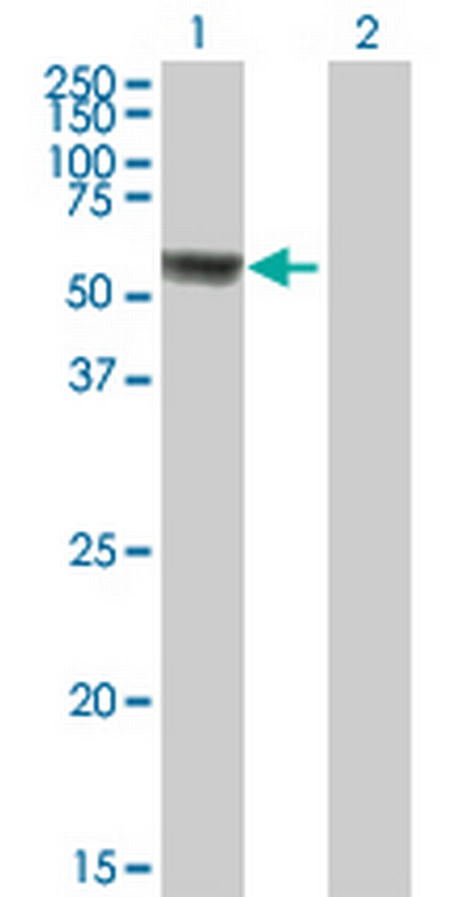 ACSF3 Antibody in Western Blot (WB)