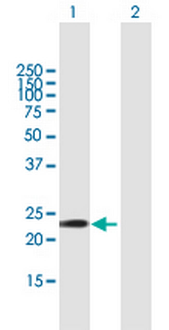 GSTA5 Antibody in Western Blot (WB)