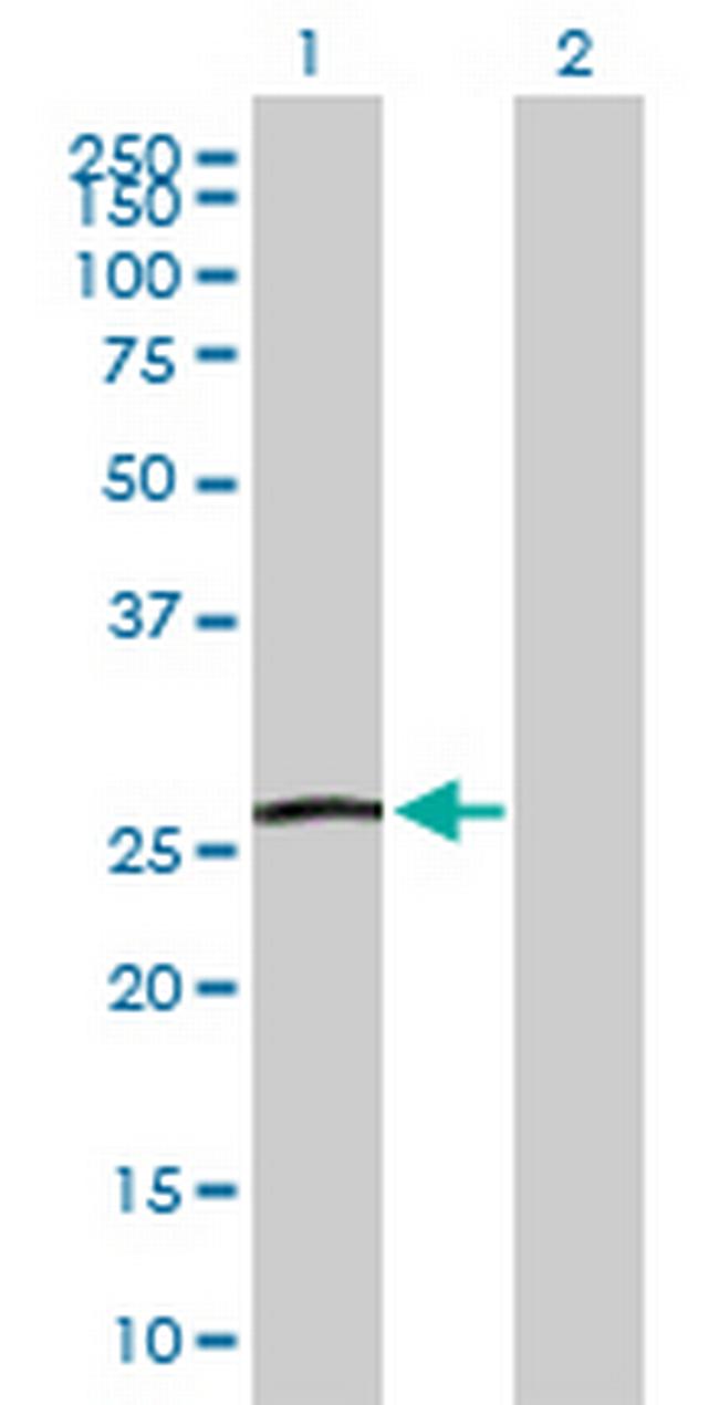 GSTA5 Antibody in Western Blot (WB)