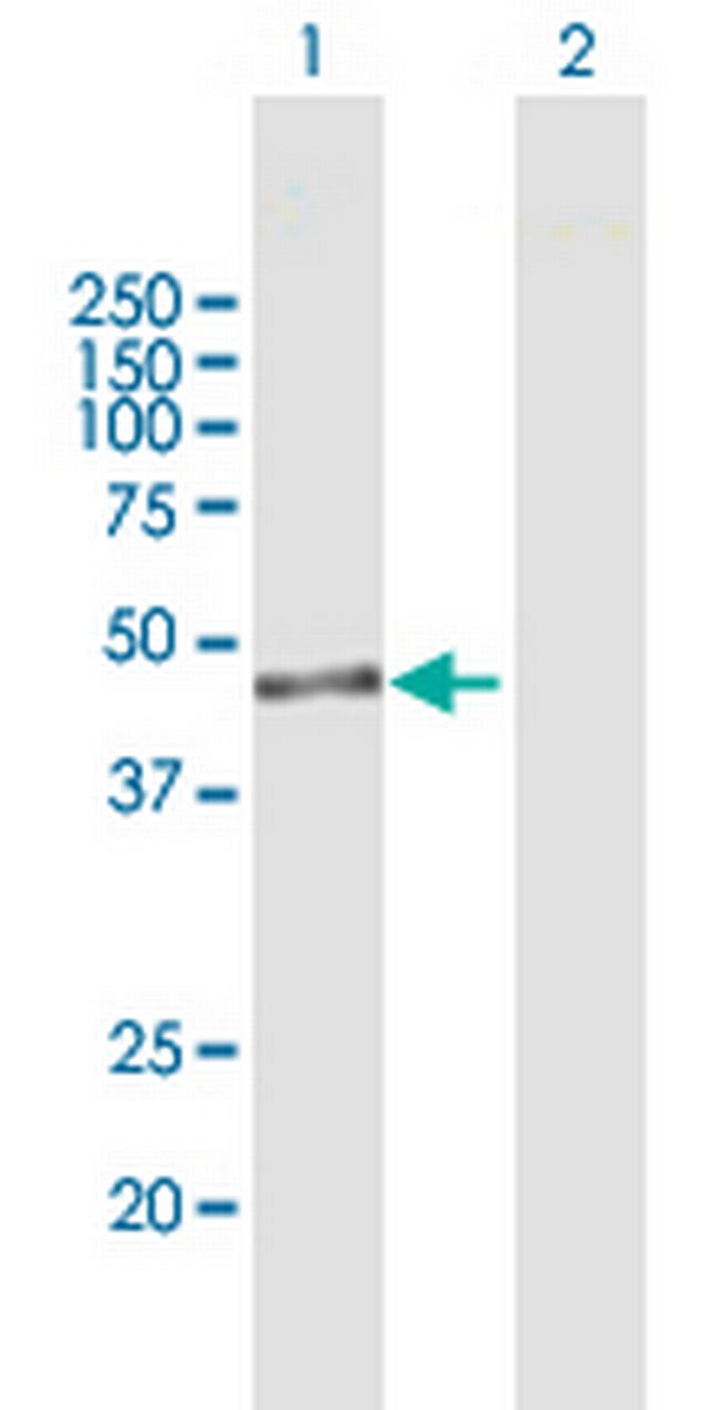 IPMK Antibody in Western Blot (WB)