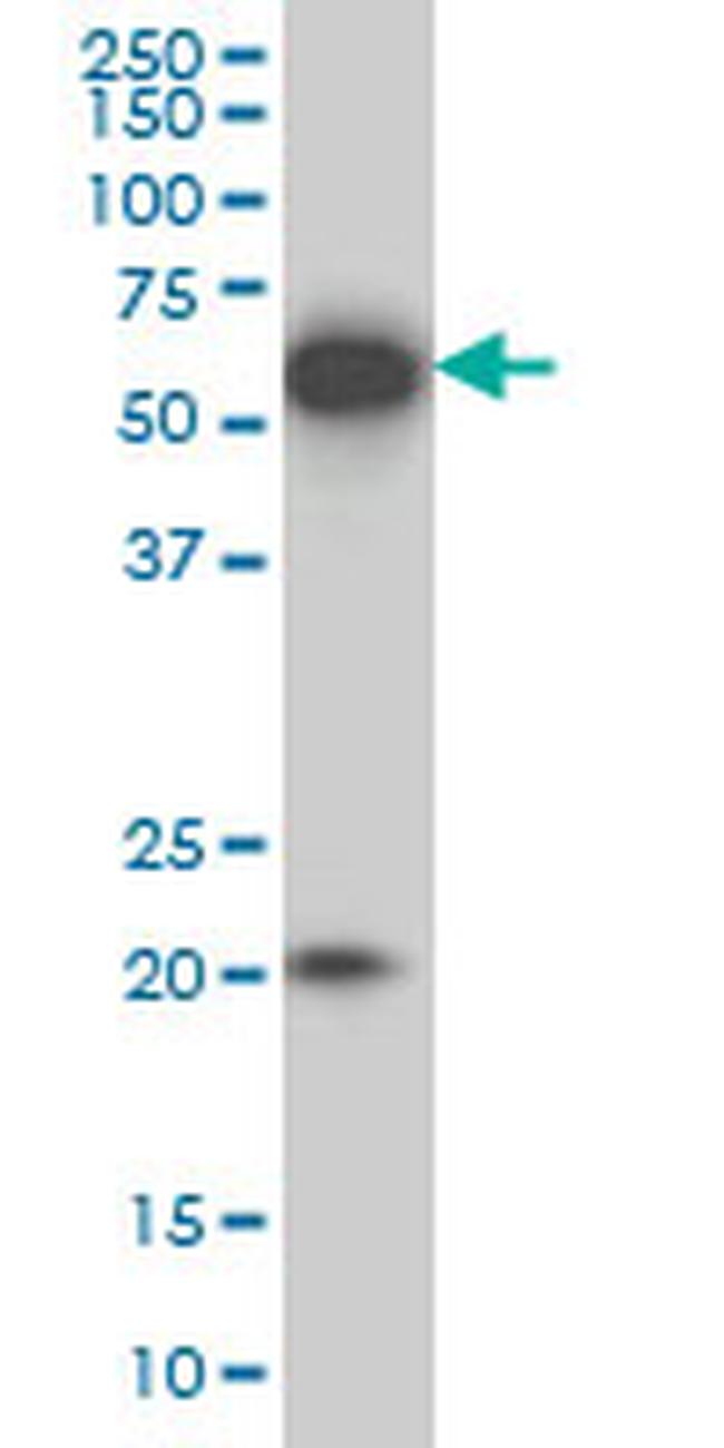 EBF3 Antibody in Western Blot (WB)