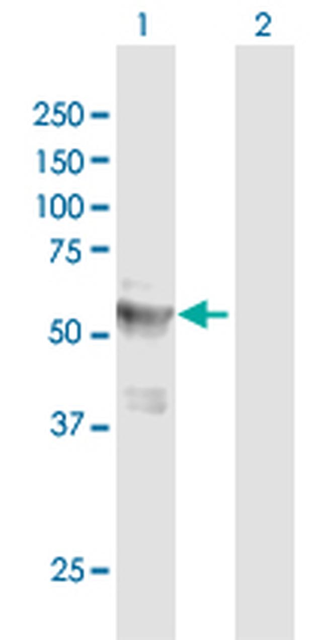 LPCAT4 Antibody in Western Blot (WB)