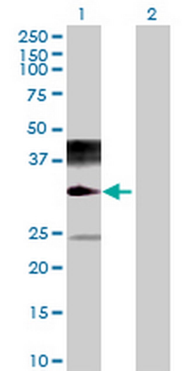 NAALADL2 Antibody in Western Blot (WB)