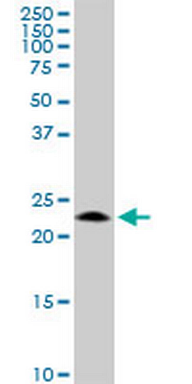 GCET2 Antibody in Western Blot (WB)
