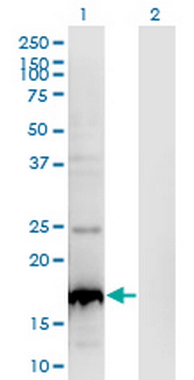 BLOC1S2 Antibody in Western Blot (WB)