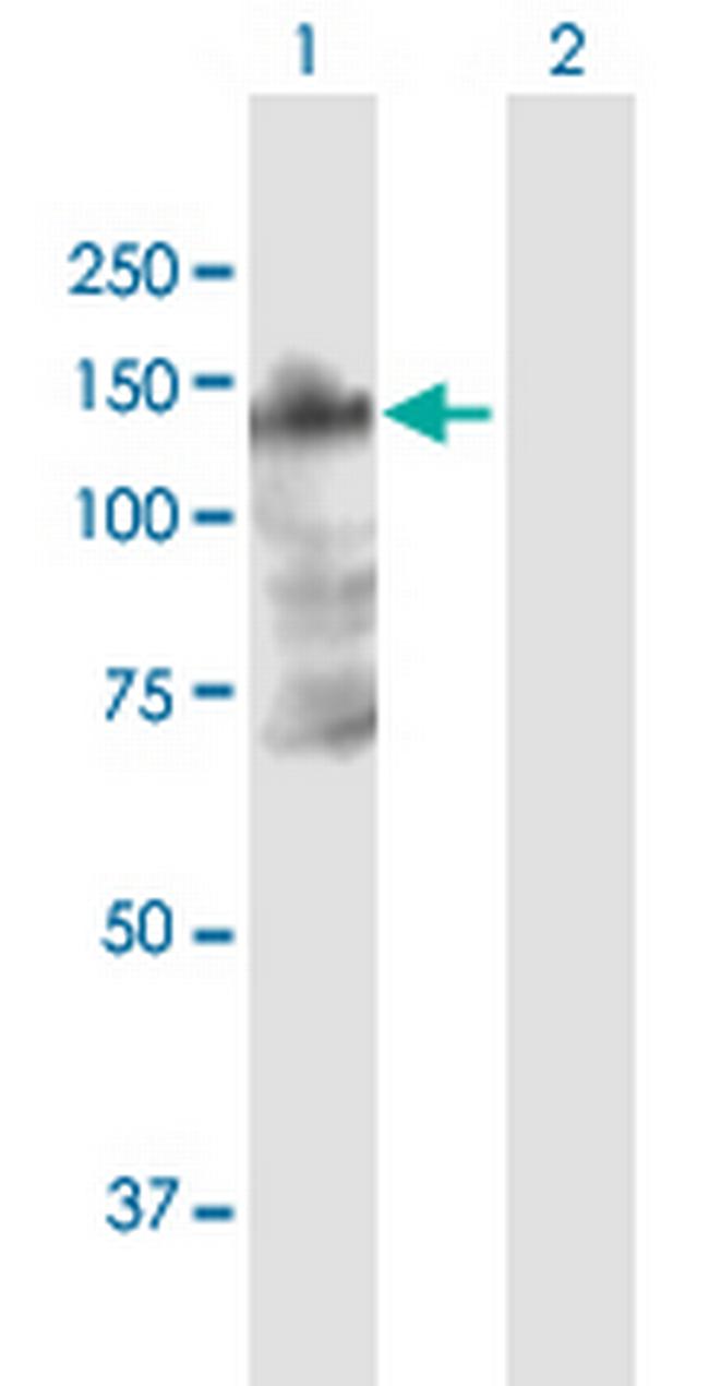 B4GALNT3 Antibody in Western Blot (WB)