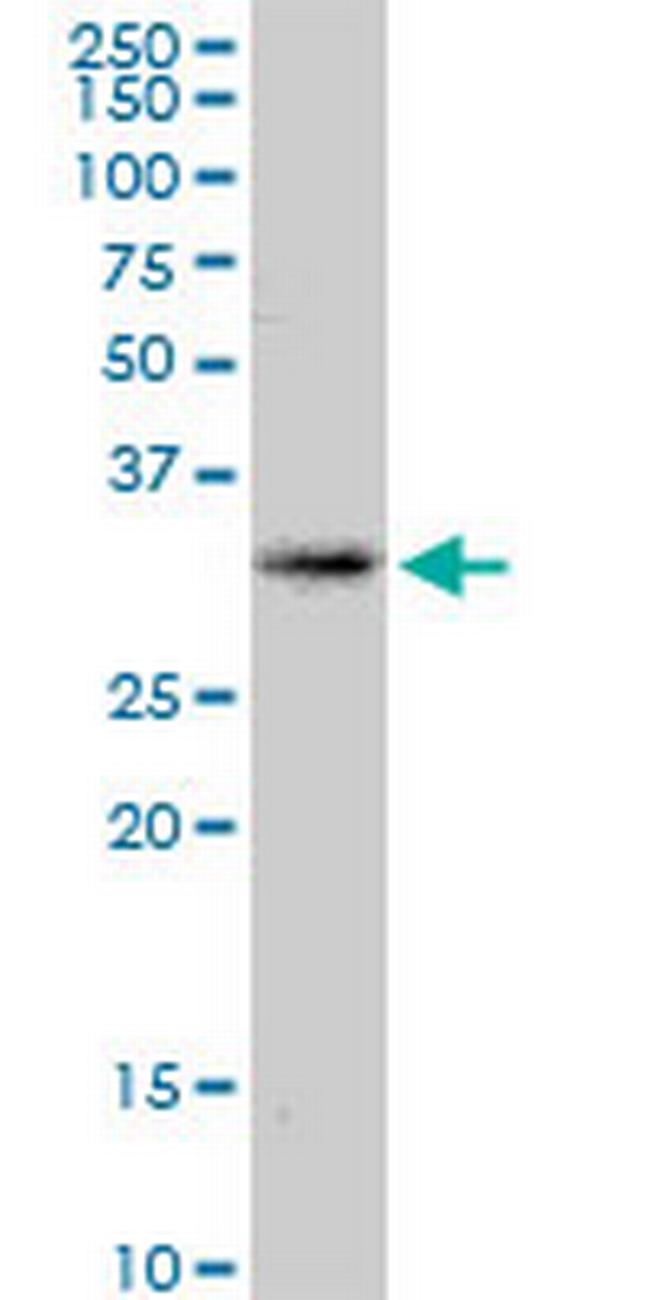KCNRG Antibody in Western Blot (WB)