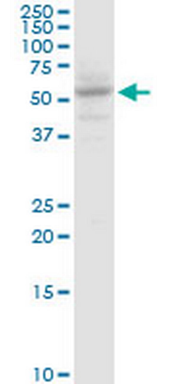 SLC13A5 Antibody in Western Blot (WB)