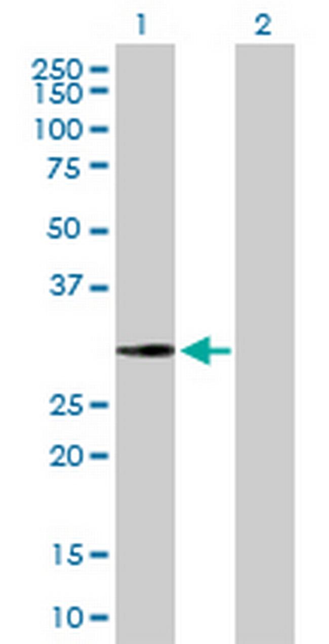FLJ35220 Antibody in Western Blot (WB)