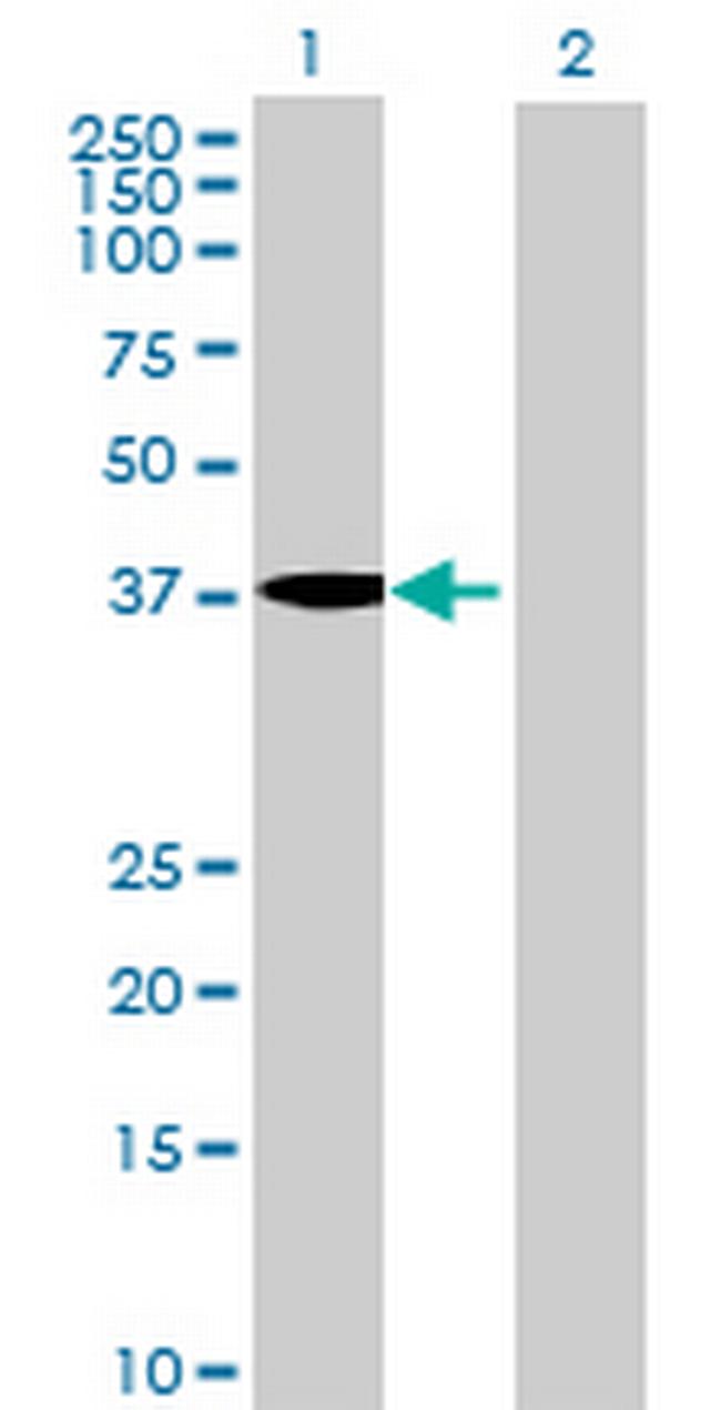 MGC33407 Antibody in Western Blot (WB)