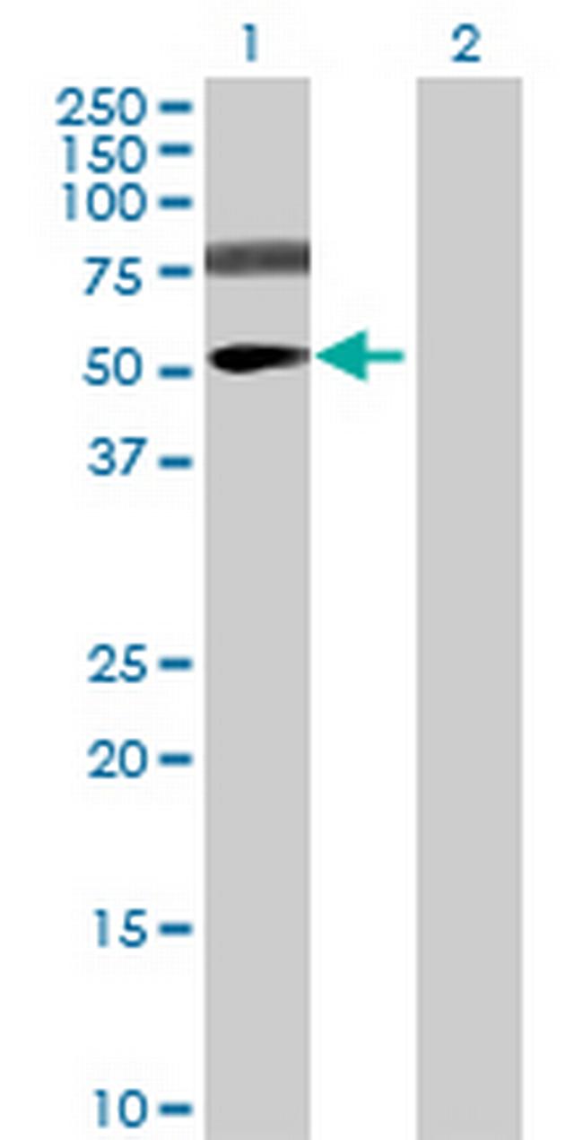 VSIG1 Antibody in Western Blot (WB)