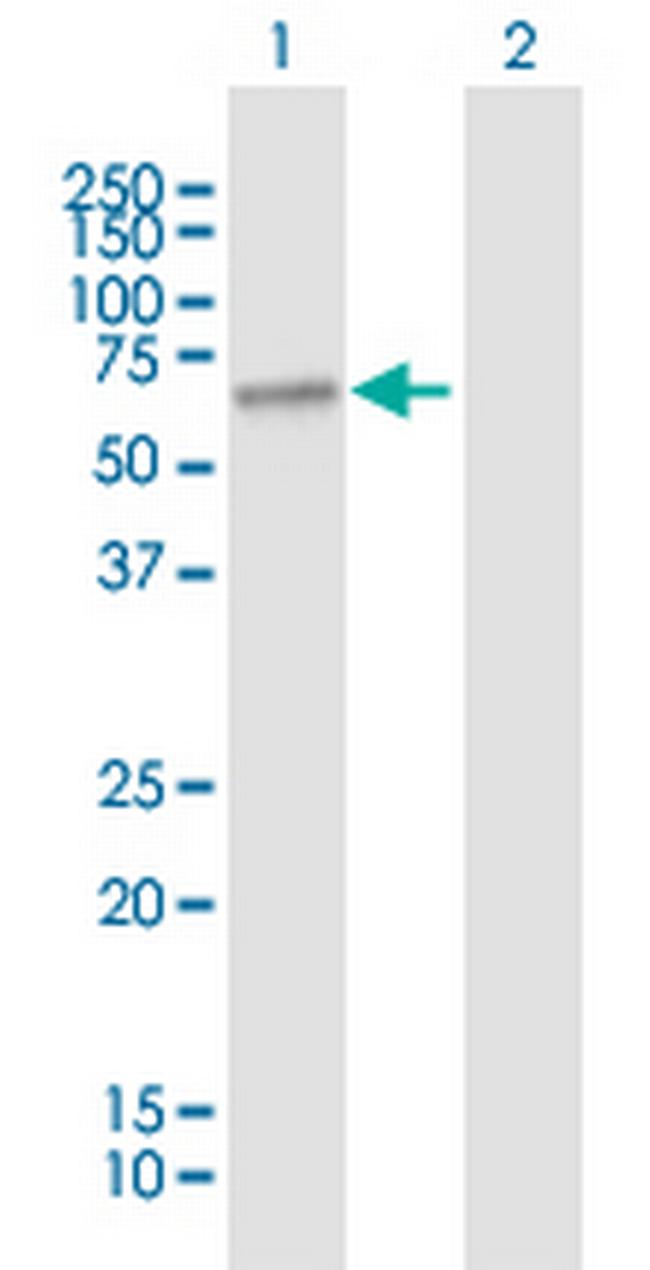SLC27A1 Antibody in Western Blot (WB)