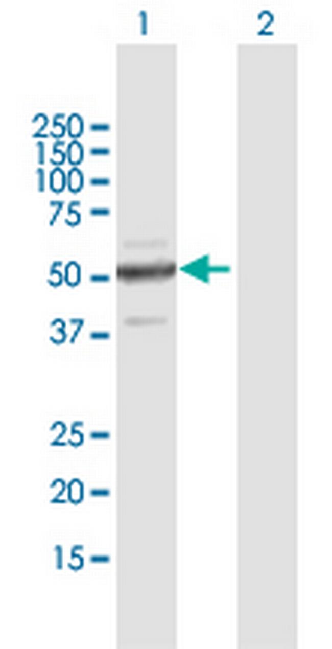 ZNF772 Antibody in Western Blot (WB)