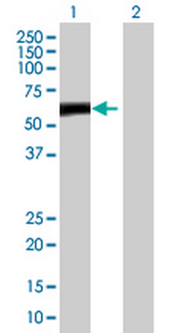 ZBTB8 Antibody in Western Blot (WB)