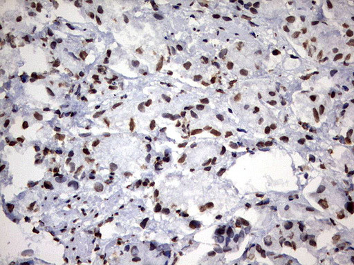 H2AFY2 Antibody in Immunohistochemistry (Paraffin) (IHC (P))