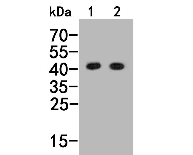 Histamine H2 receptor Antibody in Western Blot (WB)