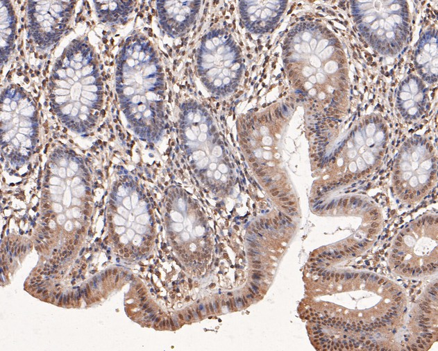 PP-X Antibody in Immunohistochemistry (Paraffin) (IHC (P))