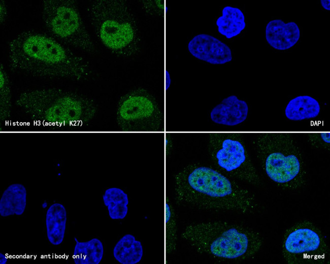 Histone H3 (acetyl K27) Antibody in Immunocytochemistry (ICC/IF)