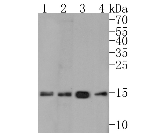 Histone H3 (acetyl K27) Antibody in Western Blot (WB)