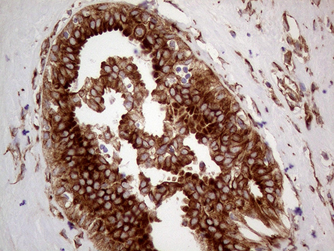 HABP2 Antibody in Immunohistochemistry (Paraffin) (IHC (P))