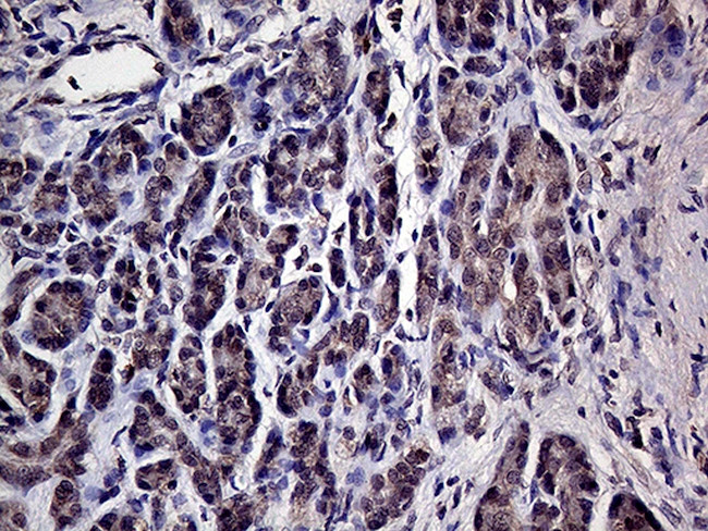 HABP2 Antibody in Immunohistochemistry (Paraffin) (IHC (P))