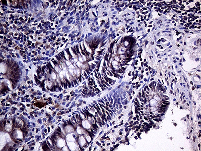 HABP2 Antibody in Immunohistochemistry (Paraffin) (IHC (P))