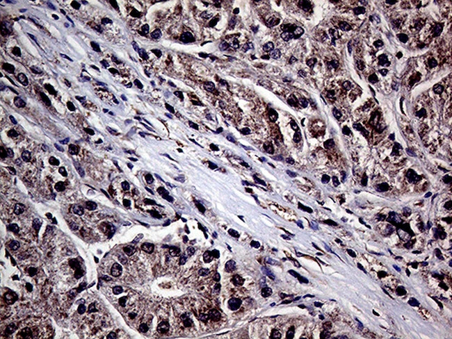 HABP2 Antibody in Immunohistochemistry (Paraffin) (IHC (P))