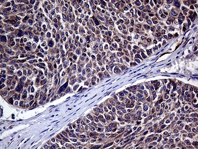 HABP2 Antibody in Immunohistochemistry (Paraffin) (IHC (P))