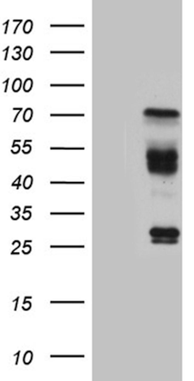 HABP2 Antibody in Western Blot (WB)