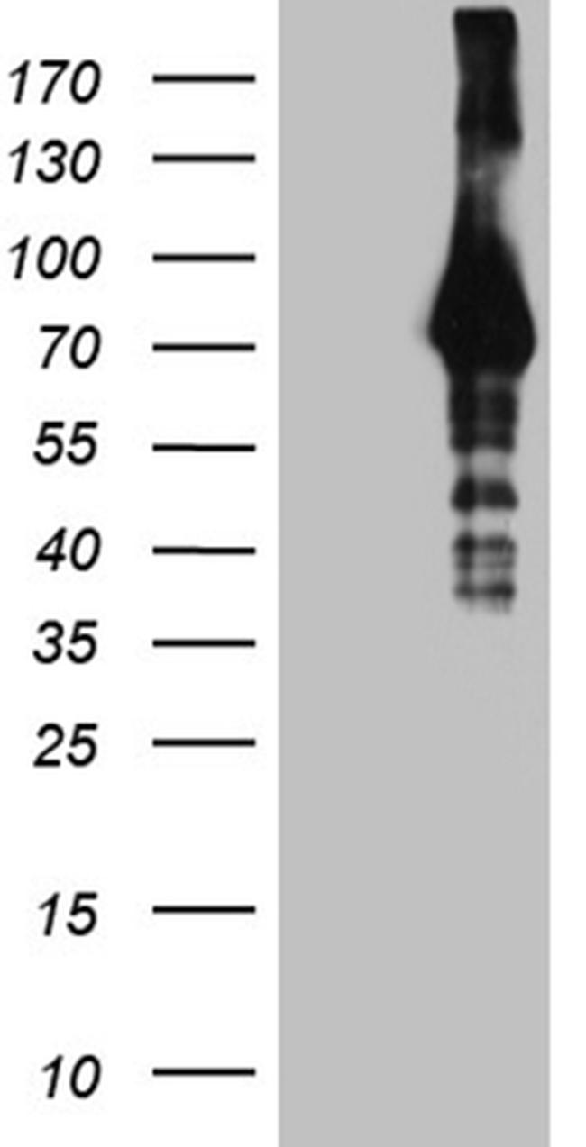 HABP2 Antibody in Western Blot (WB)